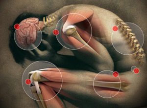 fibromialgia